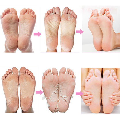 Foot exfoliating mask removes dead skin and calluses – revitalizes skin