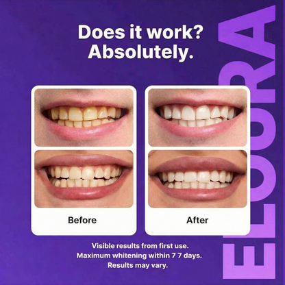 Purple Teeth Whitening Strips
