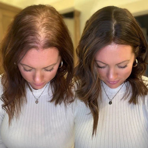 Advanced Hair Growth Roll-on Serum