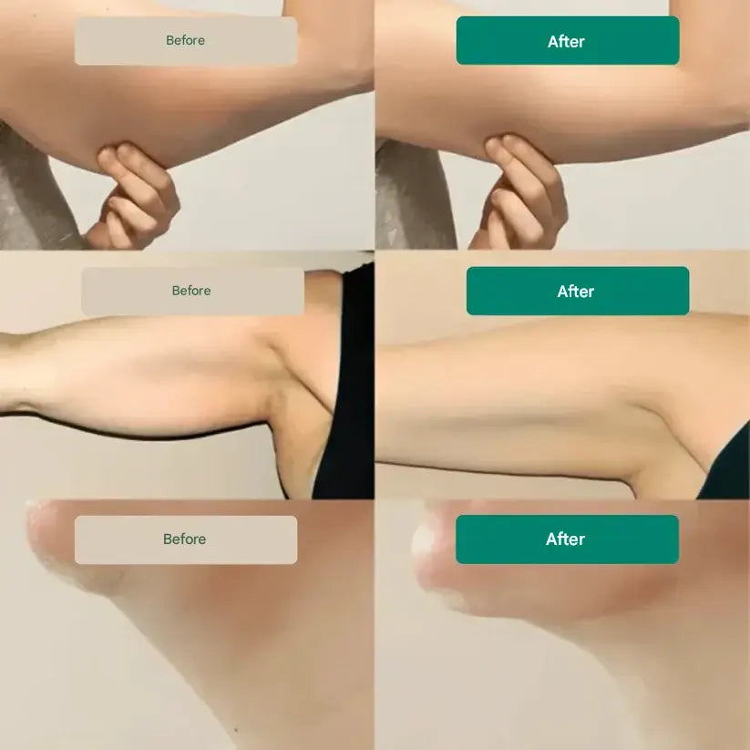 Lymphatic Drainage