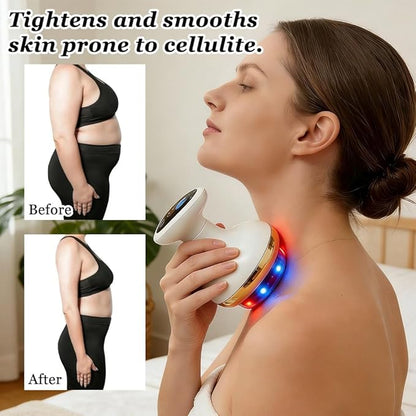 Lymphatic Drainage Massager — Eliminate Cellulite, Firm Skin, Promote Blood Circulation