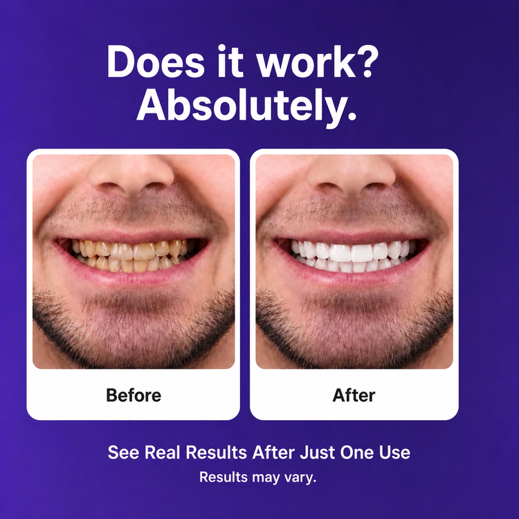 Purple Teeth WhiteningStrips