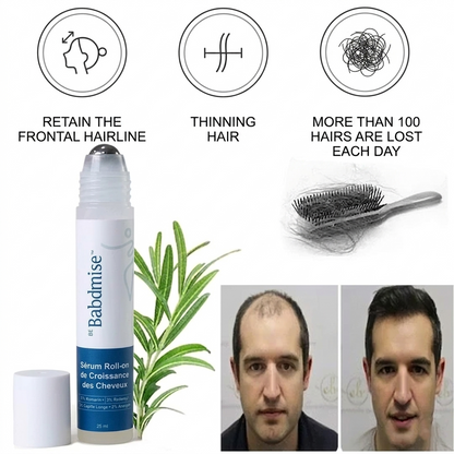 Hair Growth Roller Serum