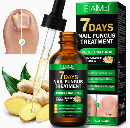 Ginger Nail Repair Essence: Repair Your Nails in 7 Days — Say Goodbye to the Urge to Hide Them