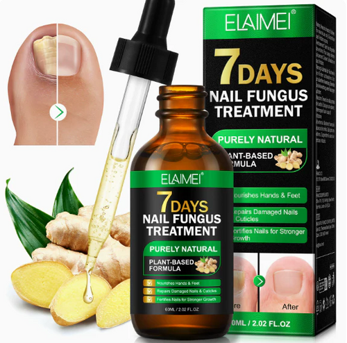Ginger Nail Repair Essence: Repair Your Nails in 7 Days — Say Goodbye to the Urge to Hide Them