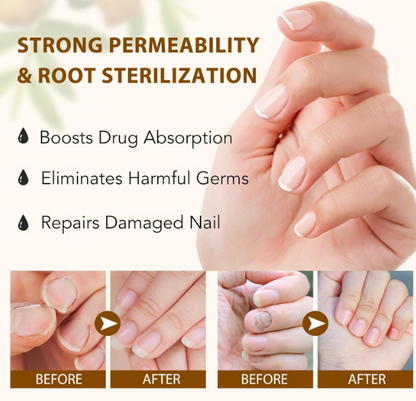 Ginger Nail Repair Essence: Repair Your Nails in 7 Days — Say Goodbye to the Urge to Hide Them