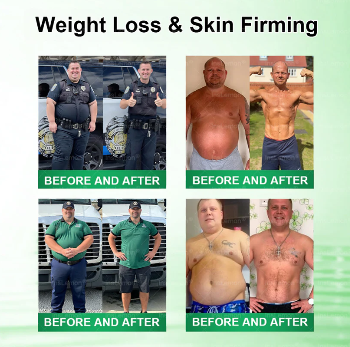 10-in-1 Metabolic Support Nano Microneedle Patchus(Just once a day, visible changes in 7 days)For obesity,OOOSG SKoO,diabetes, sleep apnea, joint issues, and more