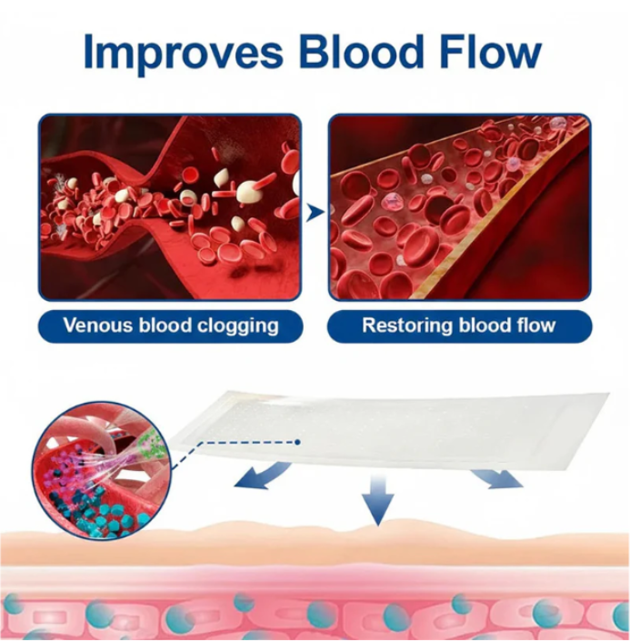 Microneedle Varicose Vein Treatment Patch